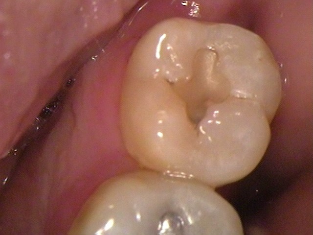 image-773487-X08880_2.jpg