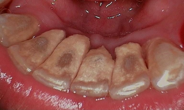 image-773760-Before-Deep-Cleaning.JPG
