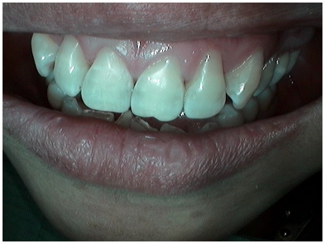 image-776261-vdentalfilling2.jpg