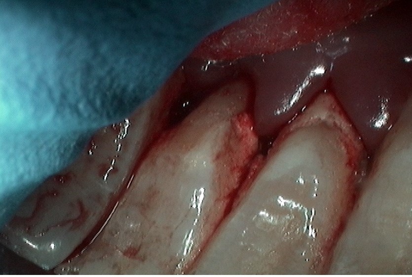 image-776300-Perio1.jpg