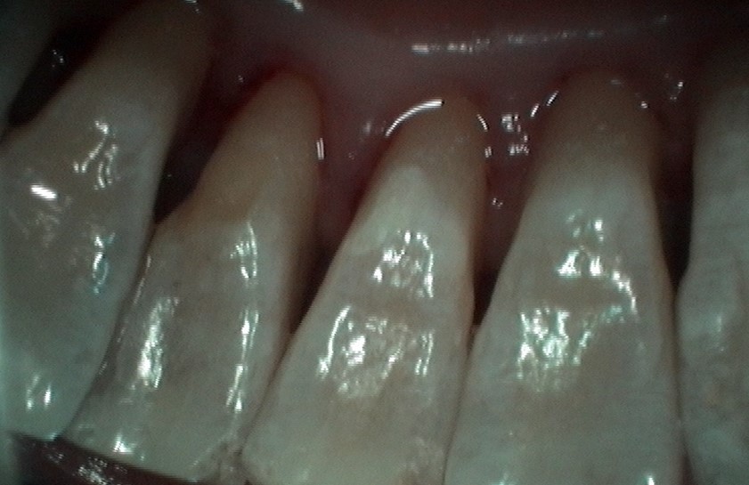 image-776301-Perio2.jpg