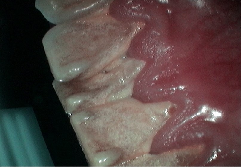image-776302-Perio3.jpg