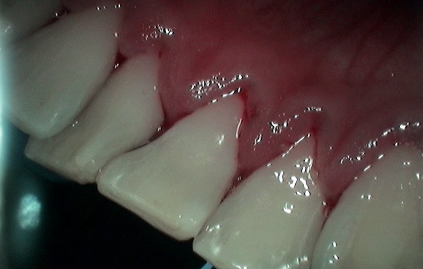 image-776303-Perio4.jpg