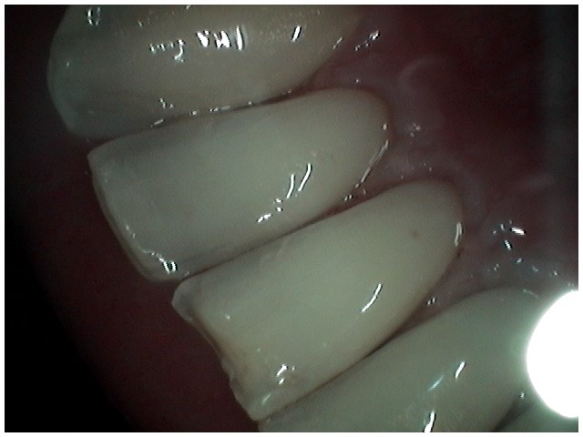 image-776305-Perio6.jpg