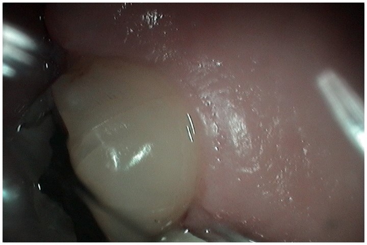 image-781788-unbleach.jpg