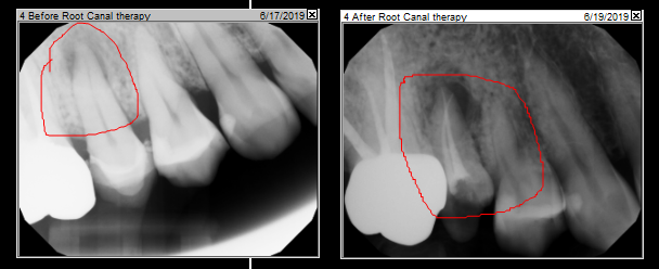 image-825498-RCTx-aab32.png